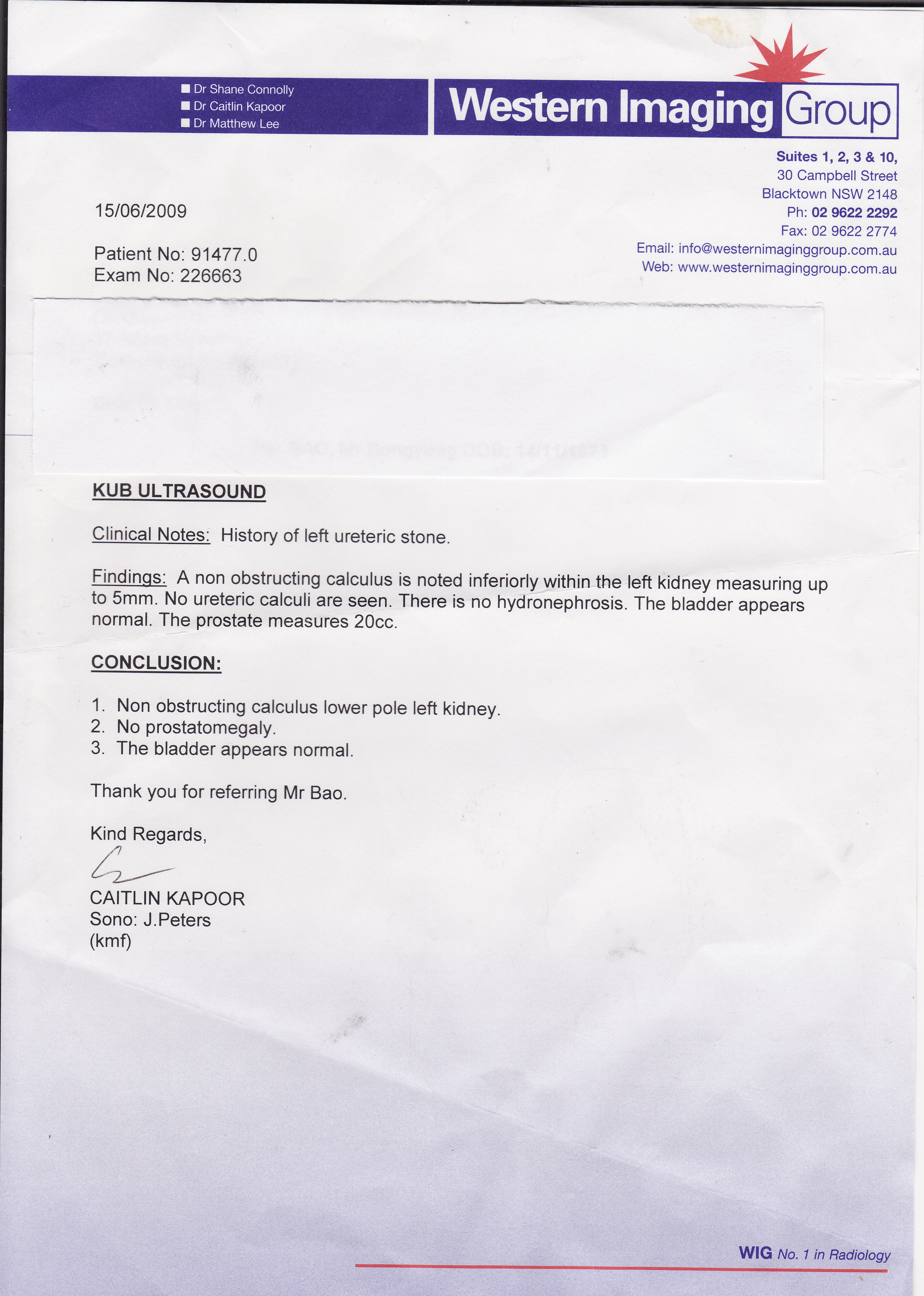 Kidney Stone Before Treatment